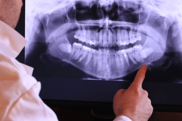 Best Cracked Tooth Emergency Dentist  in Granite City, IL