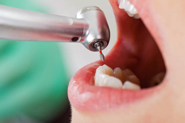 Best Urgent Tooth Repair  in Granite City, IL